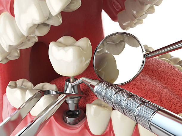 Best Mobile Emergency Dentist in Barnhart, MO